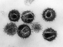 Das HI-Virus ist und bleibt eine tödliche Bedrohung.