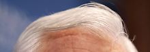 Nicht nur ältere Männer bekommen weiße Haare.