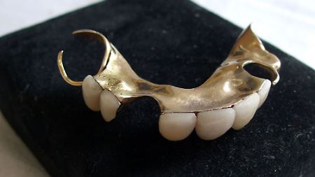 Gute Implantate sind billiger als diese Gebiss-Ikone.