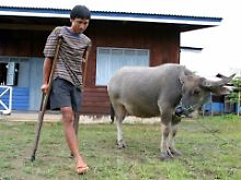 Dieser junge Mann aus Laos wurde durch eine Streubombe verletzt.