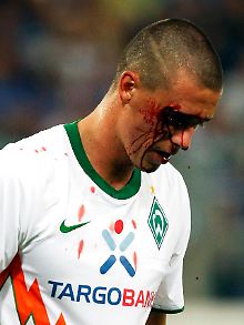 Werder musste in Genua drei Tiefschläge einstecken, ging aber nicht k.o.
