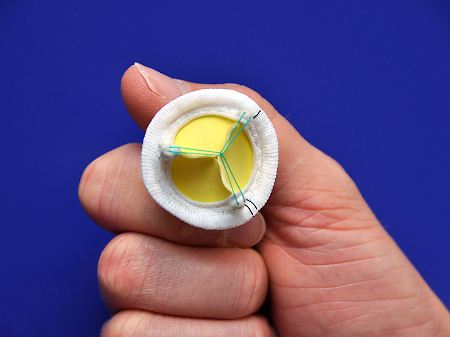 Die Magna Mitral Ease stammt vom größten Anbieter von Herzklappen dem US-amerikanischen Unternehmen Edwards Lifesciences. 