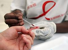 Ein Südafrikanerin unterzieht sich der Blutabnahme für einen HIV-Test.