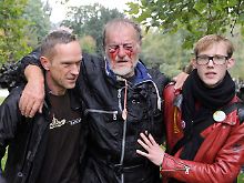 Ein verletzter Demonstrant am Donnerstagmittag. Was dem Mann genau zugestoßen ist, blieb unklar.