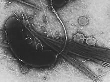 Vibrio cholerae.
