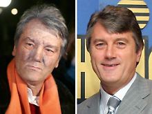 Das Bild zeigt Wiktor Juschtschenko vor (r) und nach der Vergiftung mit  TCDD. 