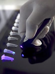 Bisher wurden Proben mit UV-Licht auf den Erreger geprüft. 