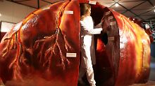 "Menschen sterben weg": Organspenden sind Mangelware
