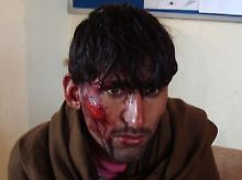 Die in Nuristan verwundeten Zivilisten werden in einem Krankenhaus in Kunar versorgt.