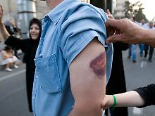 Dieser Demonstrant hat noch Glück gehabt.
