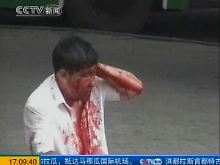 Das Bild aus einem Beitrag des chinesischen Fernsehens zeigt einen verletzten Han-Chinesen.