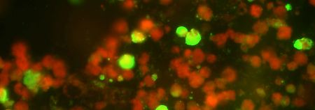 Blick durch ein Mikroskop der Medizinischen Hochschule Hannover: Die "Immunfluorenz-Methode" lässt die Influenza-Viren leuchten. Während gesunde Zellen rot erscheinen, strahlen infizierte Zellen grün.