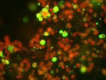 Die "Immunfluorenz-Methode" lässt gesunde Zellen rot erscheinen. Die mit dem Schweinegrippen-Virus infizierten Zellen strahlen grün. Damit kann zweifelsfrei eine Infizierung festgestellt werden.