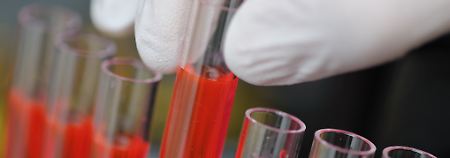 PID: Diagnose zur Früherkennung schwerer Erbschäden.