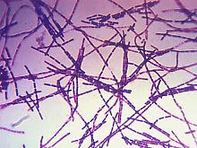 Zellen des Bacillus anthracis.