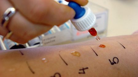 Experten raten von IgG-Tests ab.