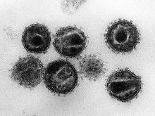 Elektronenmikroskopische Aufnahme mehrerer Aidsviren.