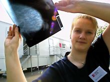 Mammografie-Bild aus einer mobilen Praxis.
