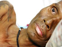  Ein Aidskranker Mann liegt in Thailand in einem Bett. 