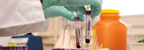 Die Erfurter Blutbestrahlung mit UVC-Licht verstößt nicht erst seit dem neuen Wada-Code gegen die Regeln, betont die Welt-Anti-Doping-Agentur.