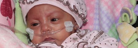 Bei den Anzeichen einer Meningokokken-Infektion gehört das Baby sofort zum Arzt.