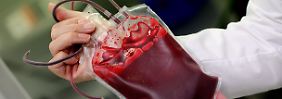 Fällt UV-bestrahltes Blut unter Doping?