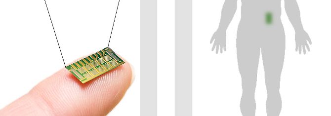 Darstellung eines Microchips, wie er jetzt bei Osteoporose-Patientinnen getestet wurde. 