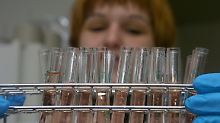 Medikamententests sollen die Aidsforschung voranbringen. Einen Impfstoff gegen die Immunschwäche gibt es nicht.