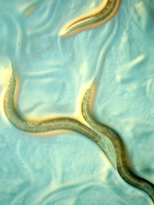 Von Caenorhabditis elegans haben Wissenschaftler den kompletten genetischen Bauplan entschlüsselt. Der winzige Fadenwurm hat wie ein Mensch ein Nervensystem, verdaut Nahrung und hat Sex. 