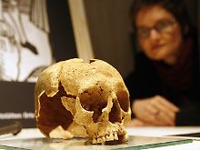 Mit einem dicken Nagel durchbohrter Schädel einer jungen Frau um 1650.
