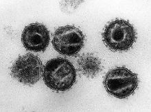 Elektronenmikroskopische Aufnahme mehrerer Aidsviren.