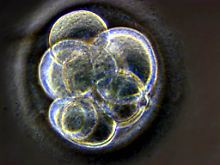 Ein drei Tage alter menschlicher Embryo-Klon. 