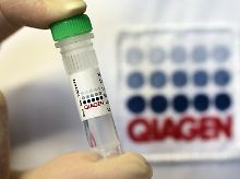 Geschäfte bei Qiagen laufen gut.