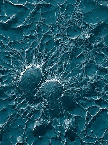 Mikroskopische Aufnahme von Staphylococcus aureus.