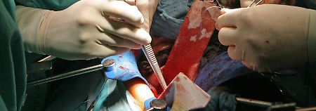 Jede Organtransplantation ist mit Risiken verbunden. 