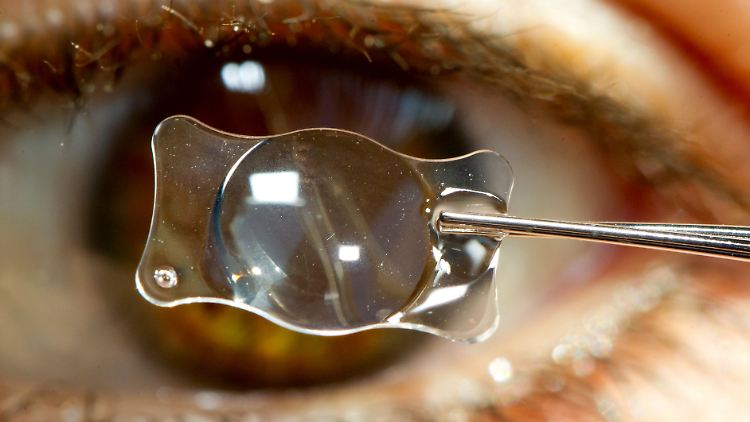 Genau hingeschaut bei Carl Zeiss Meditex