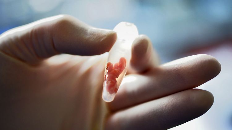 In einem Labor für Molekularbiologie des Chemischen Veterinär- und Untersuchungsamtes Rhein-Ruhr-Wupper in Krefeld wird eine Hackfleisch-Probe auf Pferde-DNA untersucht.