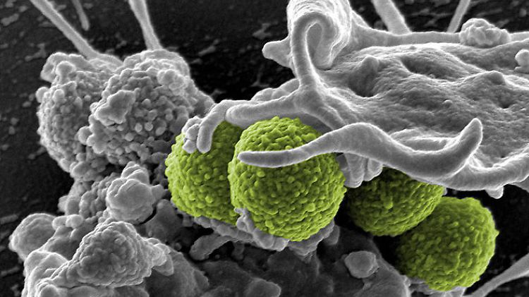 Unter dem Elektronenmikroskop: MRSA (grün) interagiert mit weißen Blutzellen.