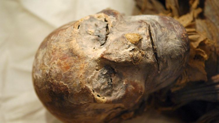 Mumien aus vier ganz unterschiedlichen Weltregionen und Epochen wiesen in einer Untersuchung Ablagerungen in den Arterien auf.