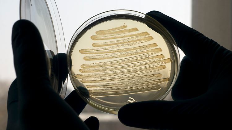 Bakterien in einerPetri-Schale: Britische Forscher zeigten in Laborversuchen, dass gentechnisch veränderte Darmbakterien Dieselkraftstoff herstellen können.