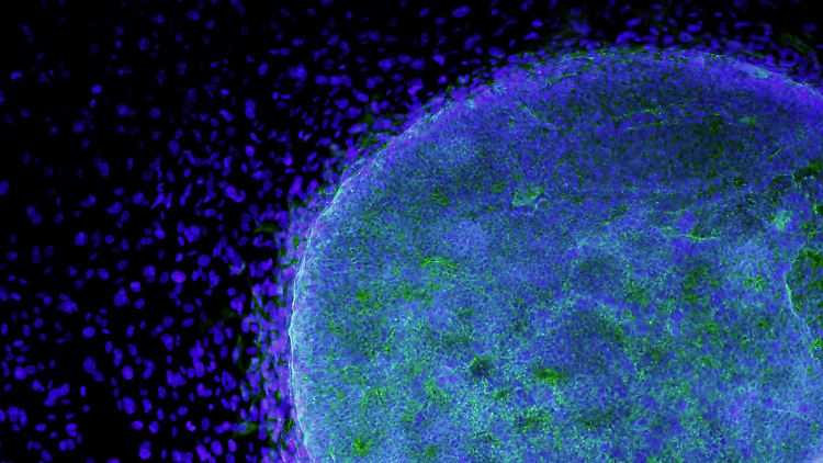 Embryonal-Stammzellenkultur im "California Institute for Regenerative Medicine".