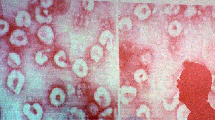 Das Coronavirus breitet sich weltweit aus.
