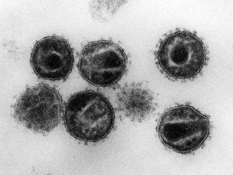 Das HI-Virus ist und bleibt eine tödliche Bedrohung.