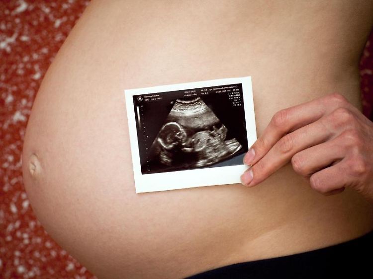 Die aufwendigere Sonographie kann Entwicklungsstörungen des Kindes aufzeigen.