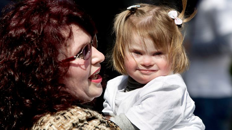 Eine Mutter mit ihrem Kind mit Down-Syndrom: Das Syndrom führt zu körperlichen und geistigen Beeinträchtigungen.