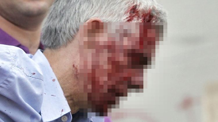 Bei dem schweren Zugunfall kam der Lokführer mit leichteren Verletzungen davon.