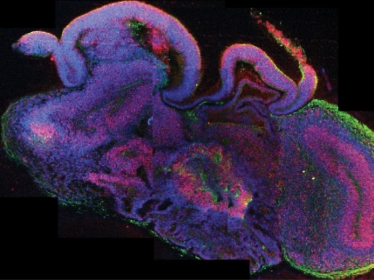 Die Querschnittsaufnahme eines cerebralen Organoids zeigt die Entstehung verschiedener Hirnregionen.
