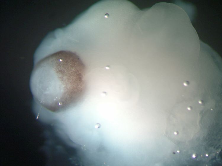 Mikroskopische Aufnahme von Gehirngewebe neben entstehendem Netzhautgewebe (braun eingefärbte Region) bei einem cerebralen Organoid.