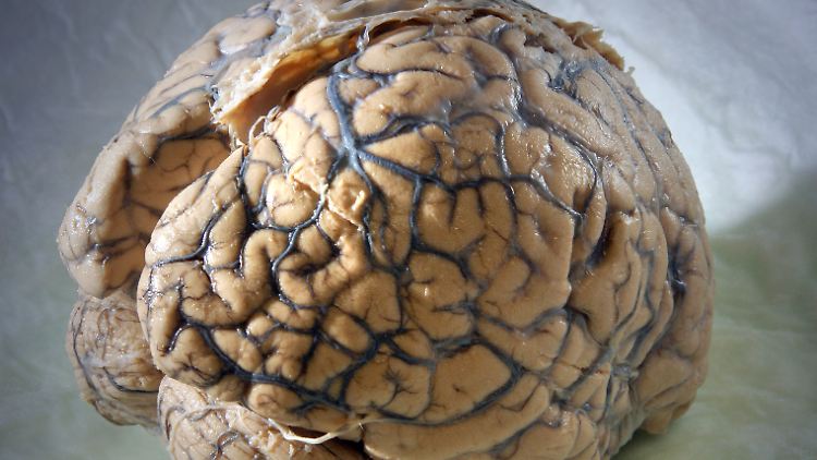 Der Hippocampus spielt bei der Erinnerung eine entscheidende Rolle.