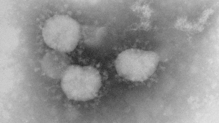 Das Coronavirus unter dem Mikroskop.